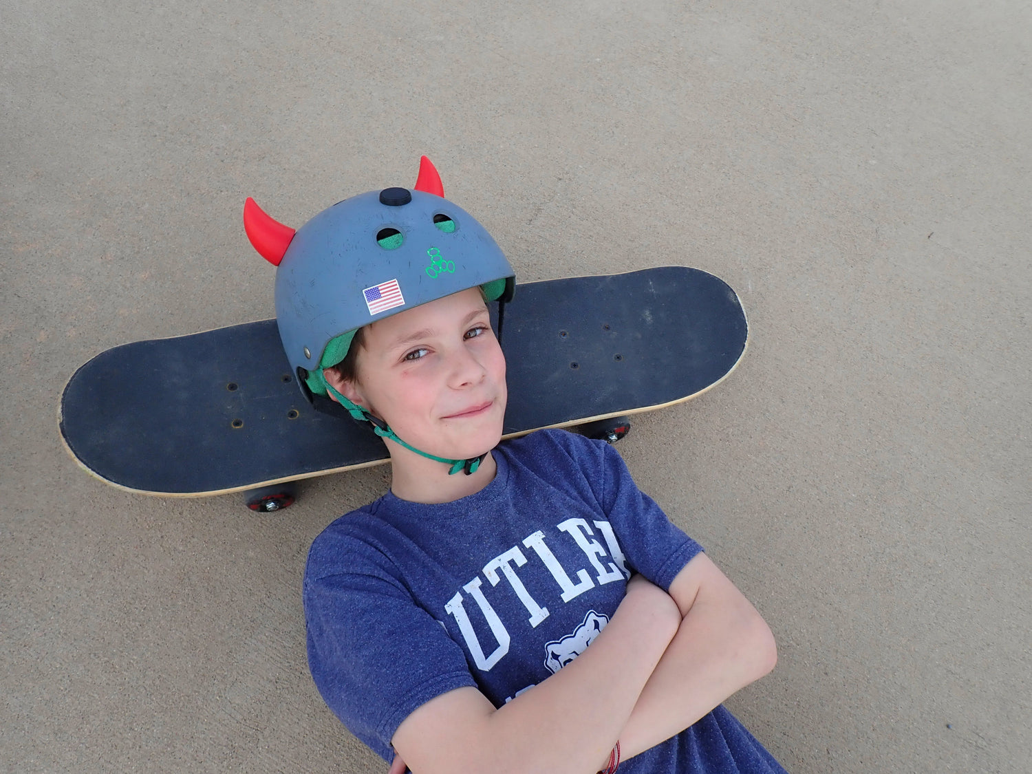 Why Skaters Don’t Wear Helmets — and Why That Needs to Change